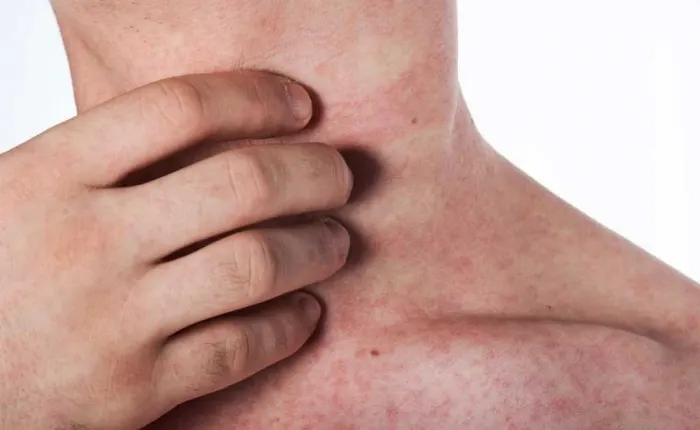 Onlayn tomosha qilish: Tasodifan mushukchaga quyish